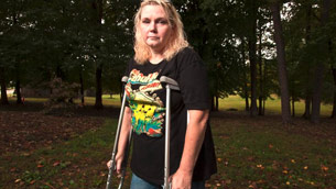 A woman with crutches standing in the grass.